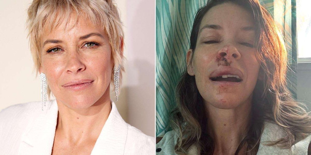 Evangeline-Lilly-D23-after-fall-010326-acf10f236c064bca96aebb2e74bdabf4.jpg - Presa360