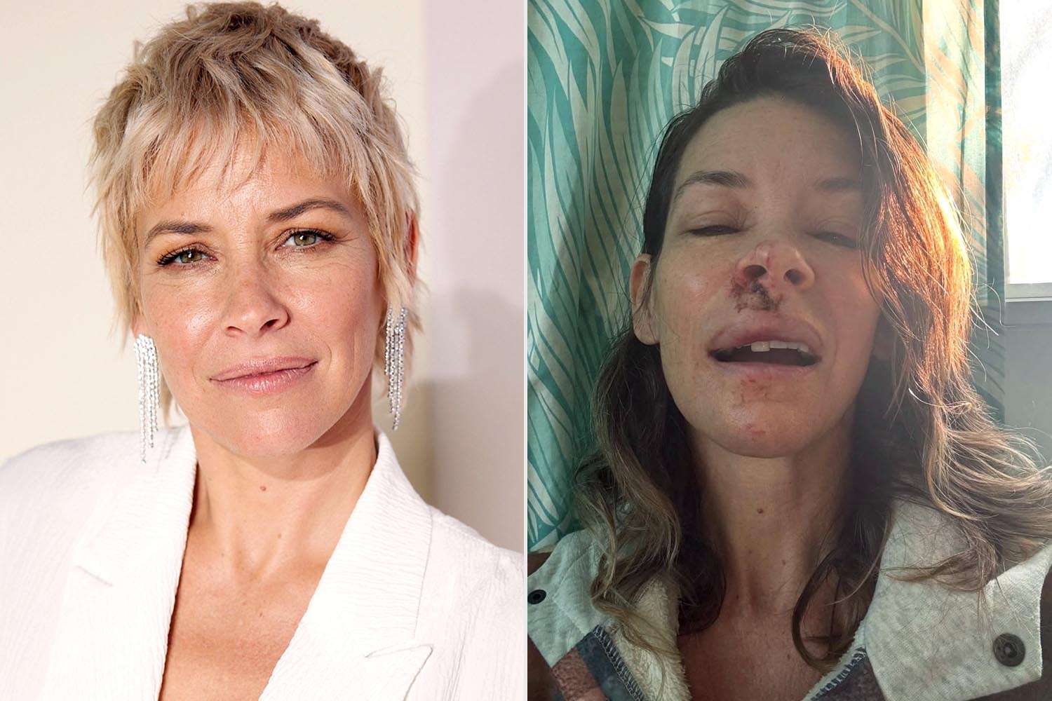Evangeline Lilly anunță că suferă de leziuni cerebrale după un accident grav Actrița Evangeline Lilly a făcut un anunț îngrijorător pe rețelele sociale, dezvăluind că suferă de leziuni cerebrale în urma unui accident suferit anul trecut