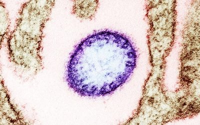 virus-Nipah.jpg - Presa360