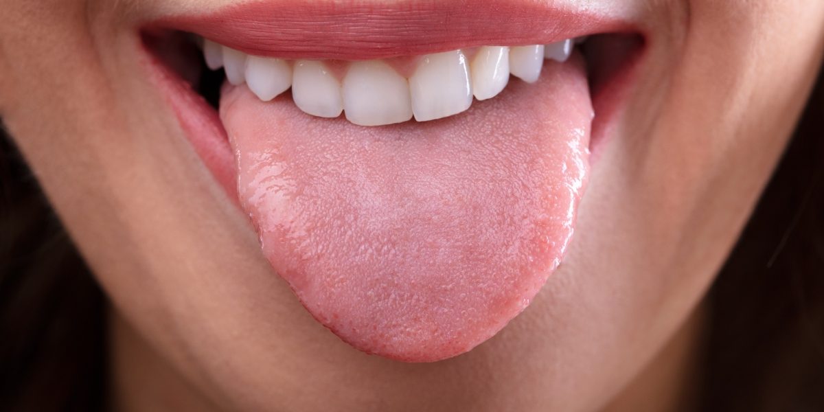 Culoarea limbii, de cele mai multe ori ignorată, poate fi un adevărat radiograf al sănătății noastre