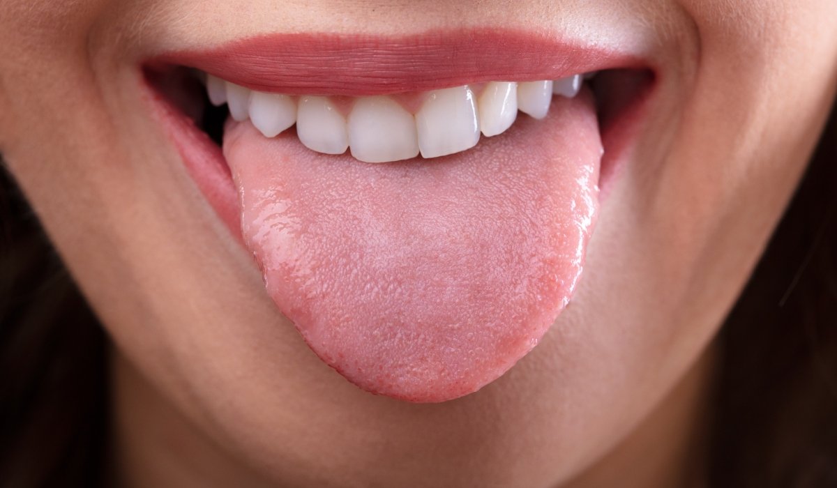 Culoarea limbii, de cele mai multe ori ignorată, poate fi un adevărat radiograf al sănătății noastre