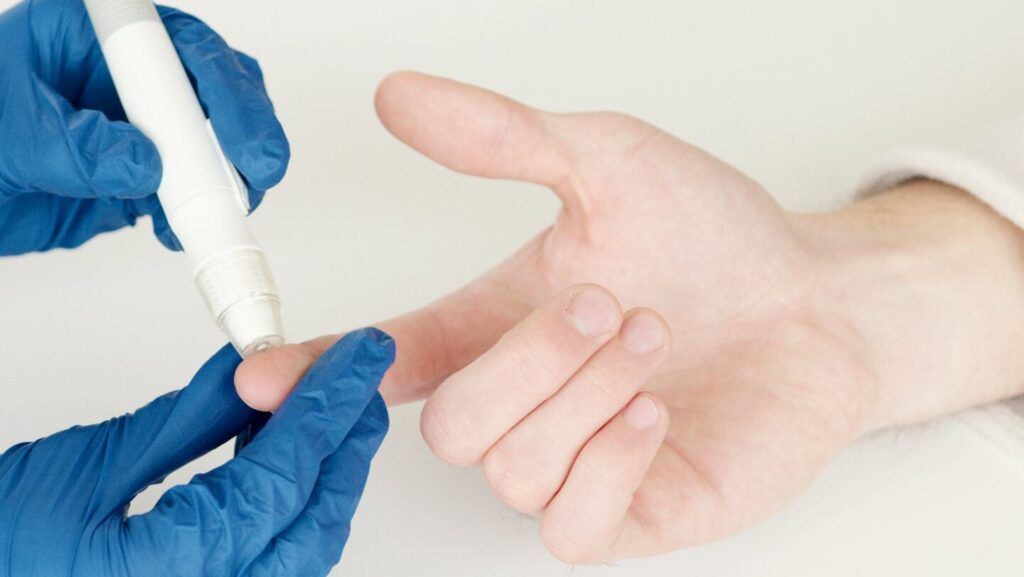 Simptomul subtil care poate dezvălui apariția diabetului zaharat: degetele mărcate de glicemie crescută Un simplu semn poate fi, uneori, un avertisment clar despre existența unui dezechilibru major în organism: aspectul degetelor mâinilor, mai ales dacă acestea prezintă zone de înțepături sau decolorare, asociate cu nivelul de glicemie din sânge