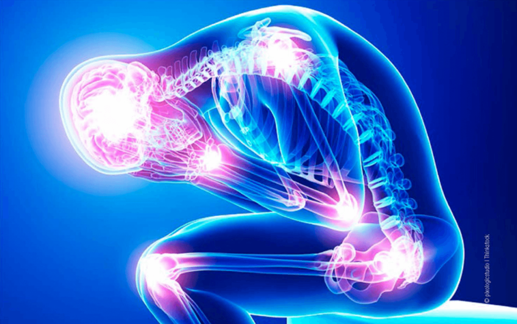 Inflamația articulară, o problemă tot mai frecventă în rândul populației, reprezintă o condiție care poate afecta zilnic milioane de oameni, chiar și înainte ca durerea intensă să devină vizibilă sau să limiteze semnificativ mobilitatea