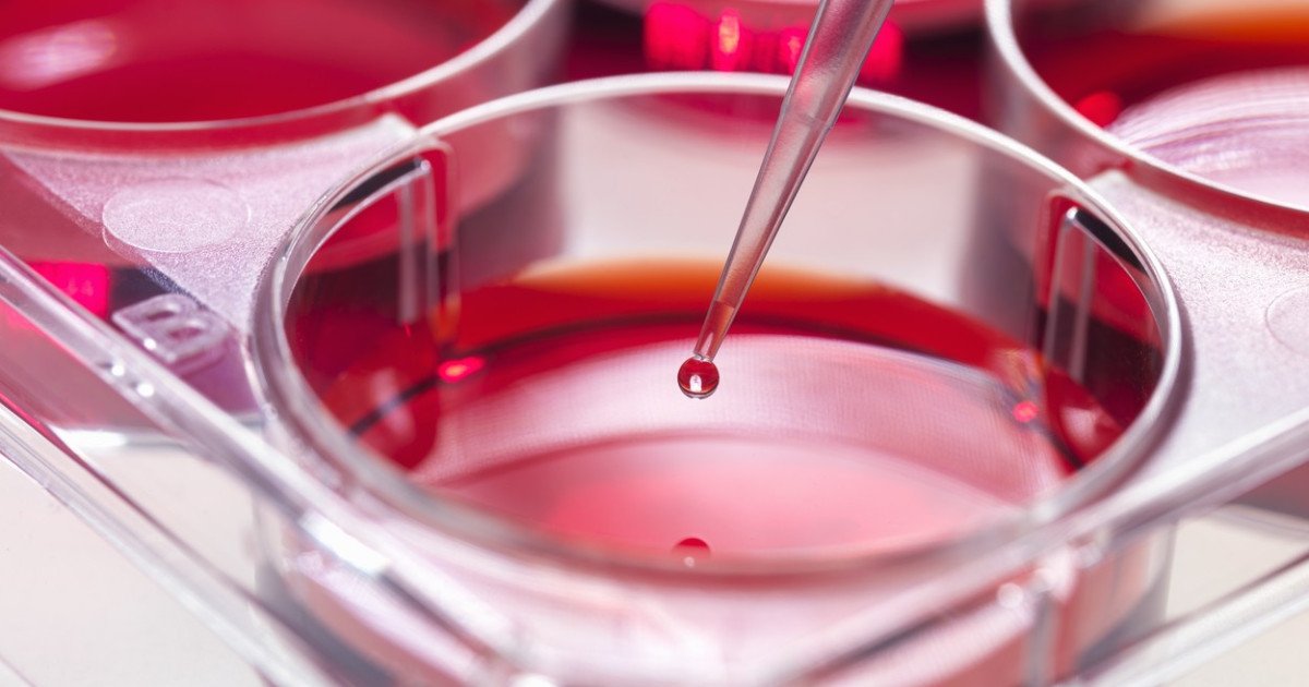 Un nou avans în înțelegerea leucemiei mieloide acute (LMA) deschide perspective promițătoare pentru tratamente personalizate, în condițiile în care cercetările recente sugerează că modul în care se gestionează semnalele din jurul celulelor stem din măduva osoasă poate schimba dramatic cursul bolii