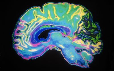 O descoperire revoluționară în cercetarea neurodegenerativă ar putea schimba abordarea tratamentelor pentru boala Alzheimer