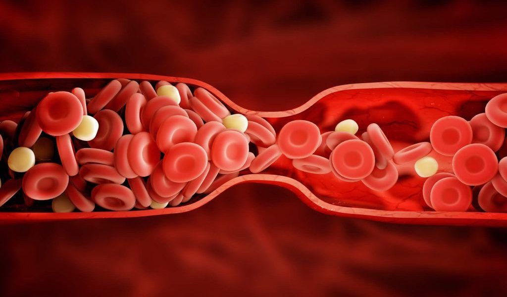 Vitamina K, esențială pentru coagularea sângelui și prevenirea sângerărilor, devine o potențială problemă pentru anumite categorii de persoane atunci când este administrată fără supraveghere medicală