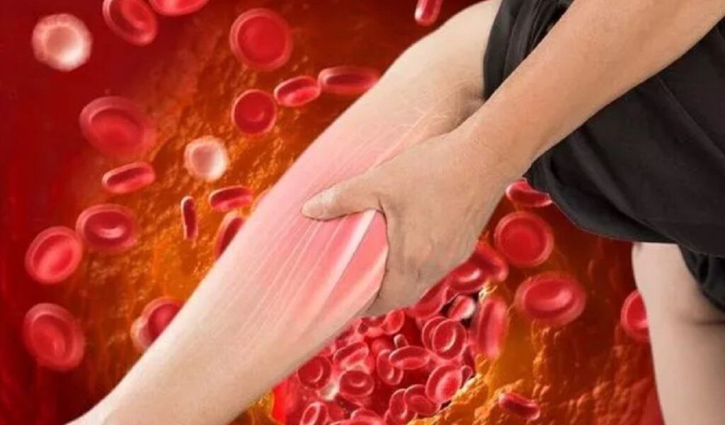 Colesterolul LDL, considerat frecvent „răul” colesterol, rămâne adesea un dușman invizibil pentru mulți adulți