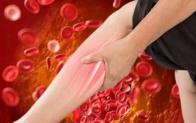 Colesterolul LDL, considerat frecvent „răul” colesterol, rămâne adesea un dușman invizibil pentru mulți adulți