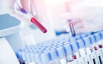 Detectarea riscului de demență înainte ca simptomele să apară: un pas important în lupta împotriva tulburărilor cognitive În ultimii ani, cercetătorii din întreaga lume depun eforturi intense pentru a identifica metode eficiente de predicție timpurie a demenței