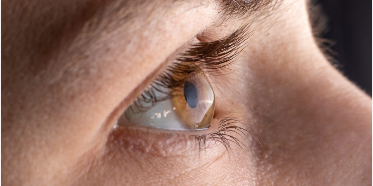 Inovație în medicină: cornee artificială realizată din solzi de pește, o alternativă promițătoare la transplant O descoperire revoluționară în domeniul transplantului ocular promite să schimbe modul în care se tratează afecțiunile grave ale corneei