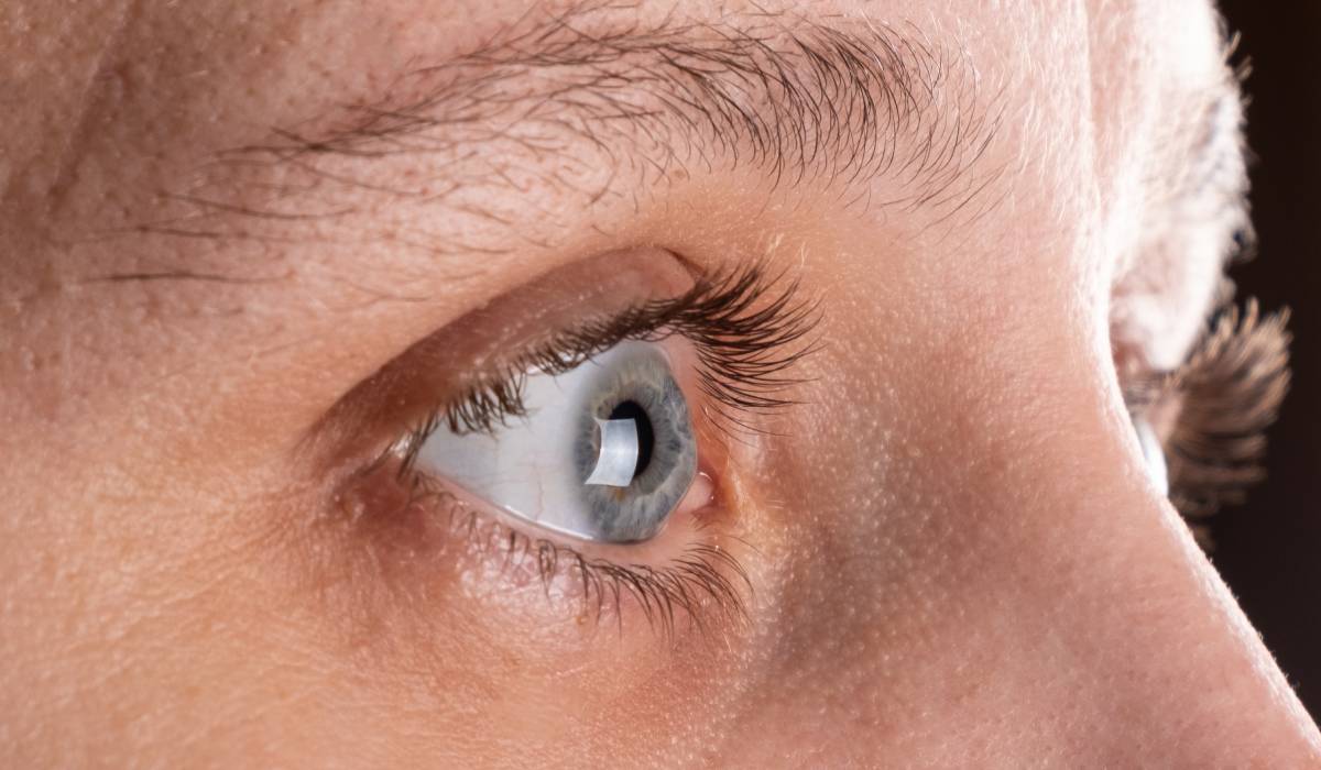 Semnul din sprâncene ce semnalează o carență nutrițională