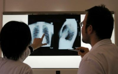 România continuă să se confrunte cu o problemă majoră de sănătate publică: incidența tuberculozei rămâne ridicată, situându-se în jurul valorii de 44,3 cazuri la o sută de mii de locuitori, conform datelor recente ale Institutului Național de Sănătate Publică
