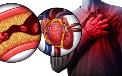 Ghidurile medicale actualizate schimbă percepția despre consumul de colesterol: tratamentul devreme devine o necesitate Noile recomandări ale unor dintre cele mai prestigioase organizații medicale din lume, precum American College of Cardiology și American Heart Association, reafirmă un fapt esențial: combaterea colesterolului nu trebuie amânată până la vârsta de mijloc, ci trebuie începută încă din tinerețe