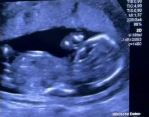 Gravidă, umilită la Filantropia București, obligată la tratament în Germania