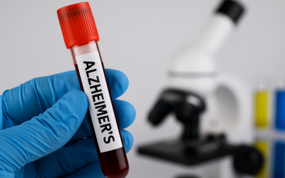 Un test de sânge simplu ar putea oferi, în viitorul apropiat, posibilitatea de a identifica riscul de demență cu decenii înainte de apariția simptomelor