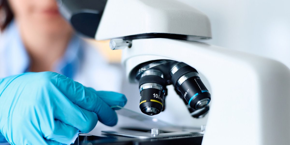 Indiciu crucial în celulele nervoase: Revoluție în tratarea Parkinson?