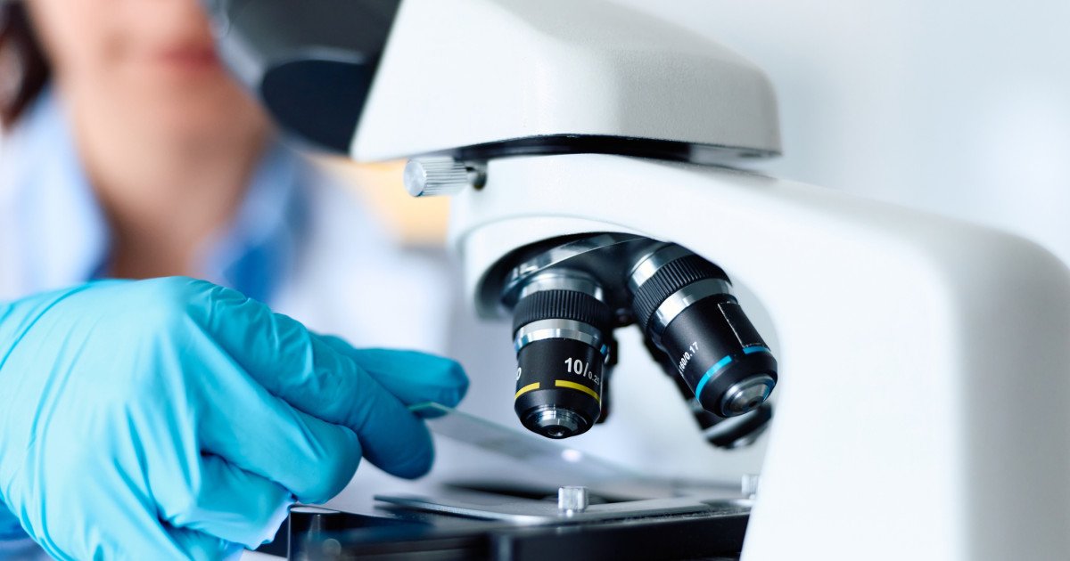 Indiciu crucial în celulele nervoase: Revoluție în tratarea Parkinson?