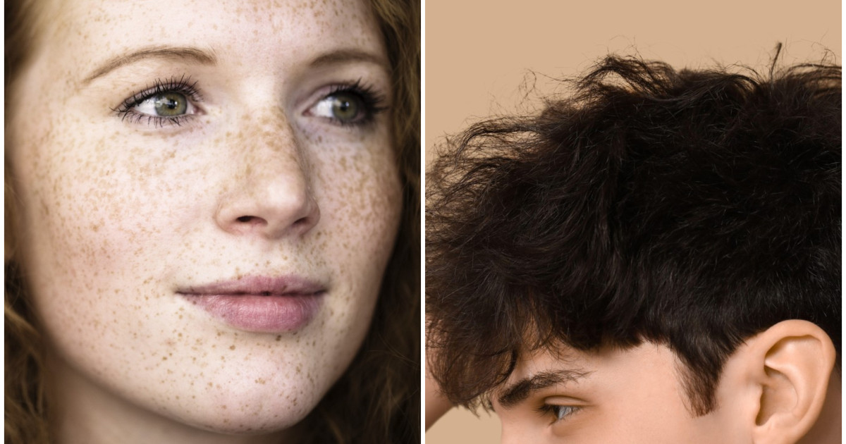 Roșcații și bărbații fără chelie, avantajați de selecția naturală