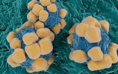 Oamenii de știință au creat senzori extrem de subțiri, capabili să detecteze biomarkeri ai cancerului Un progres important în domeniul medicinei personalizate și al diagnosticării timpurii a bolilor greu de identificat a fost realizat recent de către cercetători