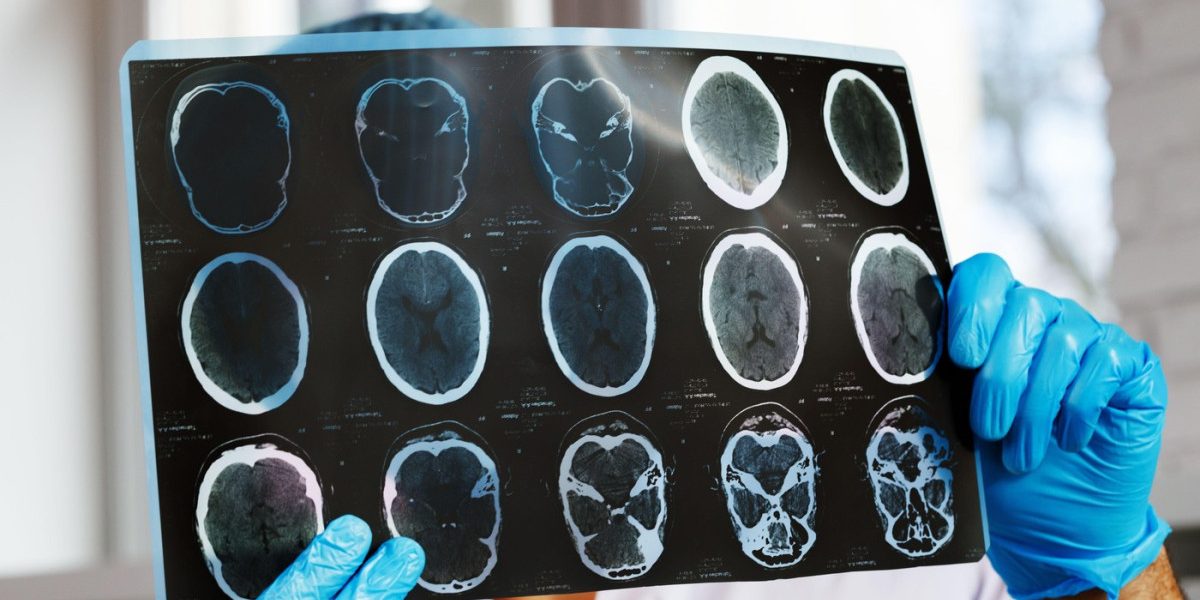 Asociațiile de pacienți cer Ministerului Sănătății și CNAS intervenții după o scădere de 47% a investigațiilor de monitorizare