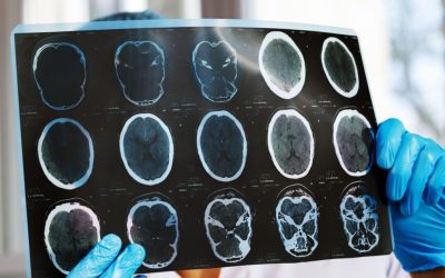 Asociațiile de pacienți cer Ministerului Sănătății și CNAS intervenții după o scădere de 47% a investigațiilor de monitorizare