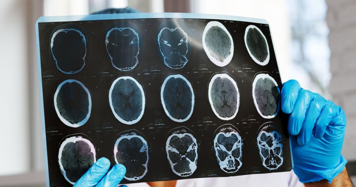 Asociațiile de pacienți cer Ministerului Sănătății și CNAS intervenții după o scădere de 47% a investigațiilor de monitorizare