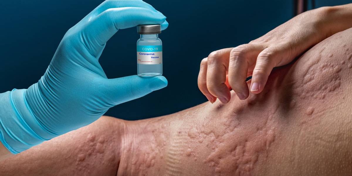 Primele semne de alergie apărute la șase luni, în timpul diversificării La doar șase luni, o fetiță din România a început să manifeste primele simptome ale alergiilor alimentare, o perioadă considerată critică pentru stabilirea sensibilităților