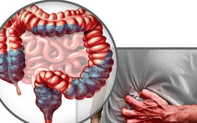 Aproape jumătate dintre adulți nu sunt conștienți de legătura directă dintre consumul anumitor alimente și riscul crescut de cancer colorectal