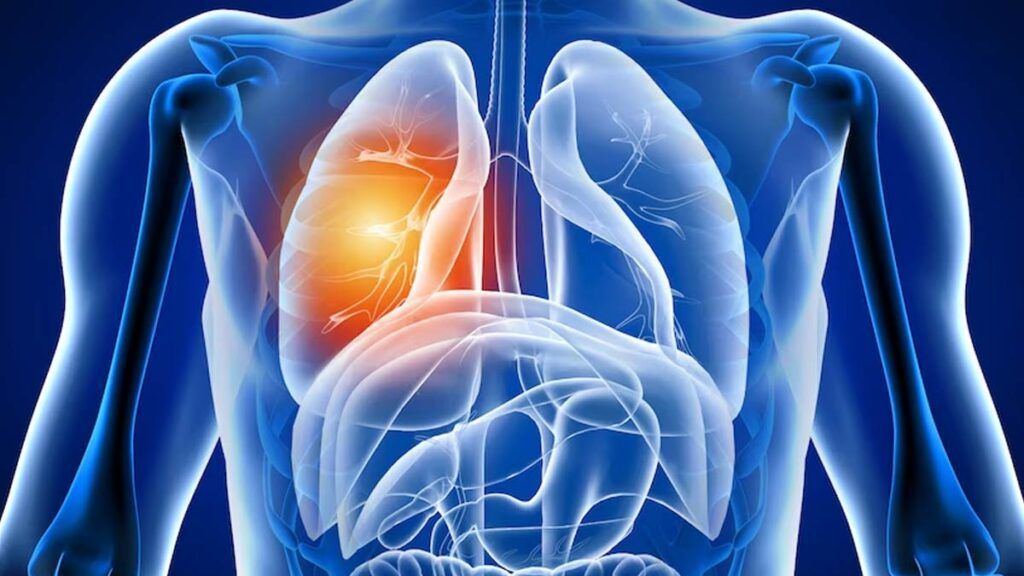 Alarmă: Ce se întâmplă cu plămânii după COVID-19? Studiu îngrijorător