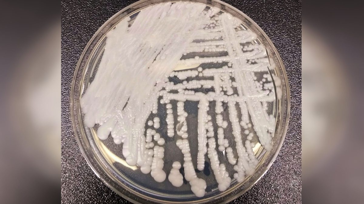 Candida auris, pericol în România și Europa: Pot fi oprite infecțiile