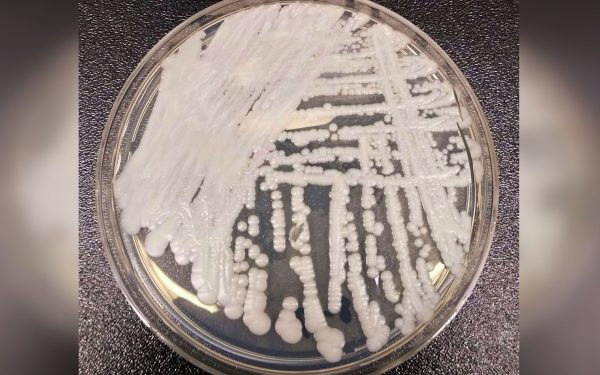 Candida auris, pericol în România și Europa: Pot fi oprite infecțiile