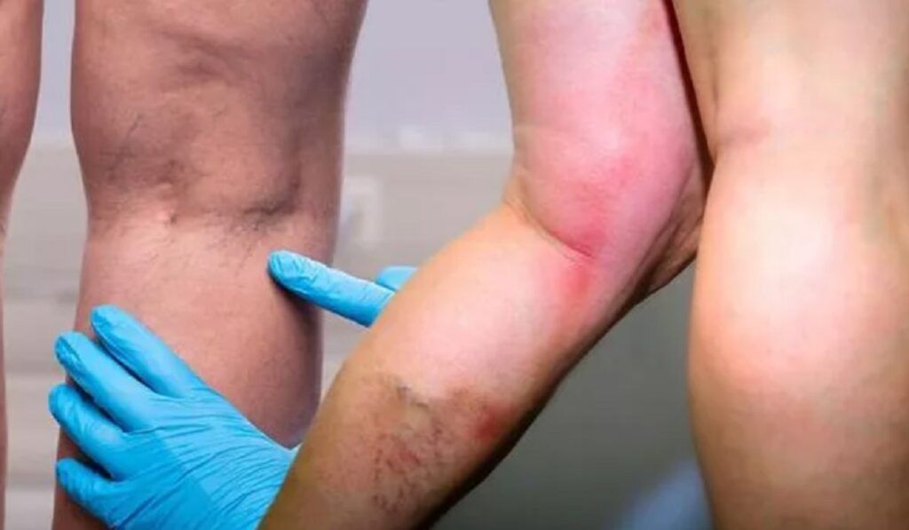 Vitamina-minune: Scut anti-cheaguri și imunitate de fier