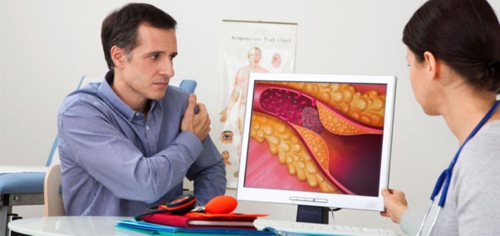 Cardiologii americani avertizează: noi ghiduri pentru colesterol și riscul de infarct