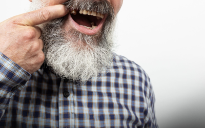 Pacientul vrea dinți noi rapid, dar fără compromisuri. Ce soluții sunt?