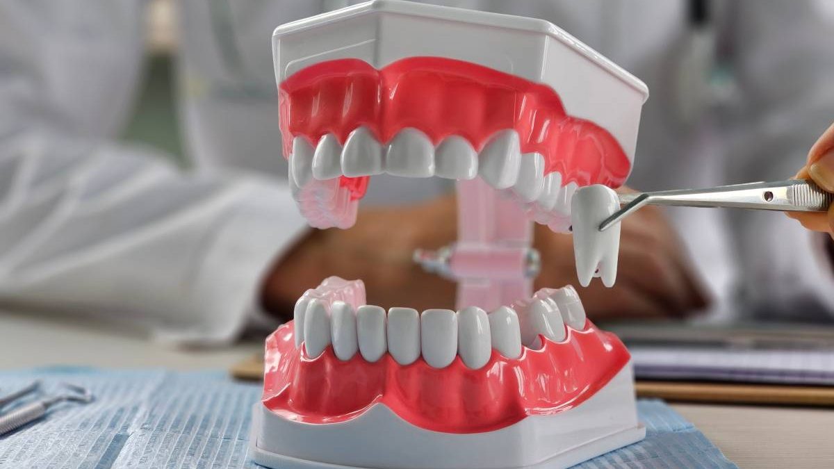 Extracție vs. fără extracție în ortodonție: Medicii dezbat, pacienții așteaptă