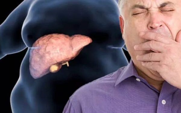 Boala ficatului gras: Tratament revoluționar, fără dietă! Noua veste a cercetătorilor