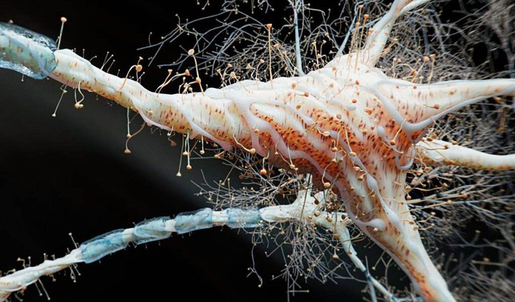 O nouă cercetare aruncă o lumină proaspătă asupra sclerozei multiple (SM), indicând o posibilă legătură directă între inflamația intestinală și declanșarea bolii autoimune care afectează sistemul nervos central