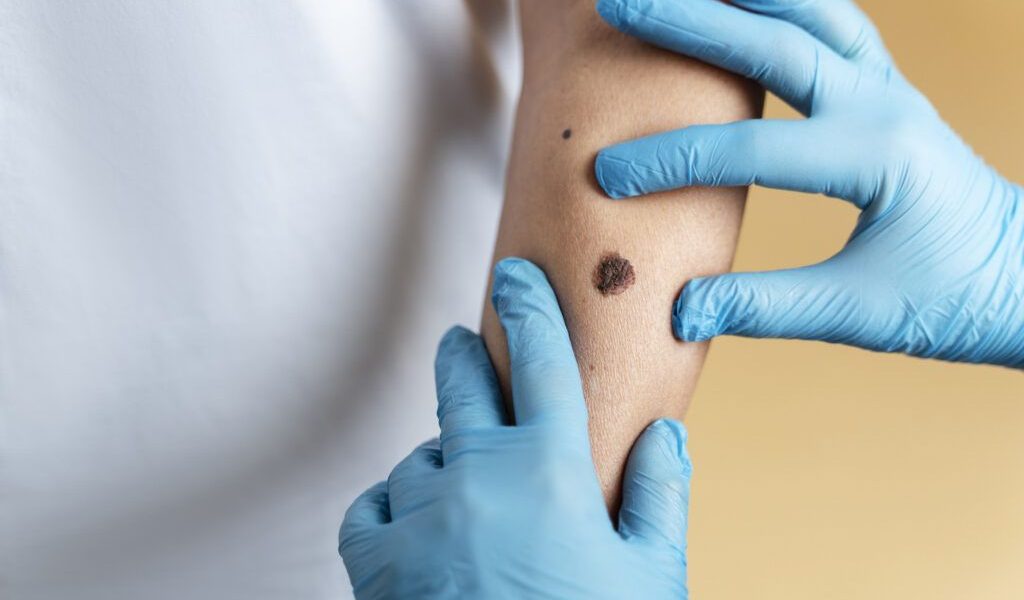 O femeie de 37 de ani, mamă a doi copii, a decedat după ce o afecțiune gravă a fost ignorată în stadiu incipient, în ciuda semnalelor de alarmă evidente