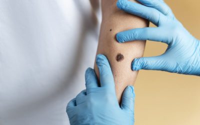 O femeie de 37 de ani, mamă a doi copii, a decedat după ce o afecțiune gravă a fost ignorată în stadiu incipient, în ciuda semnalelor de alarmă evidente