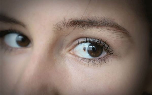 11 semne ascunse de cancer în ochi: Atenție la aceste simptome!