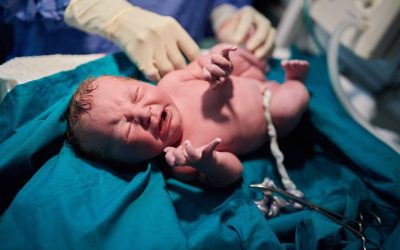 Riscul de AVC la adulți, legat de greutatea la naștere Un studiu realizat până în 2022 a indicat că au fost înregistrate 2.252 de cazuri de accident vascular cerebral (AVC) în România