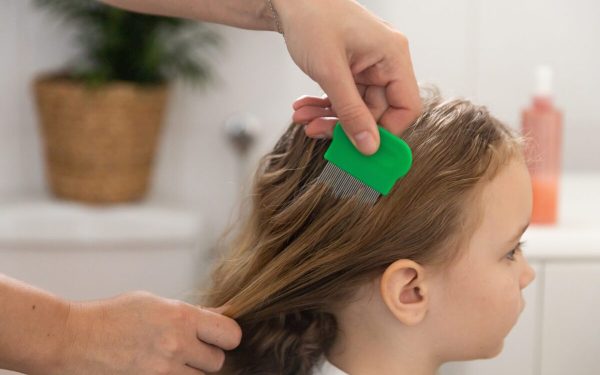 Remedii NATURALE ANTI-PĂDUCHI: Ce funcționează cu ADEVĂRAT pentru copii și adulți