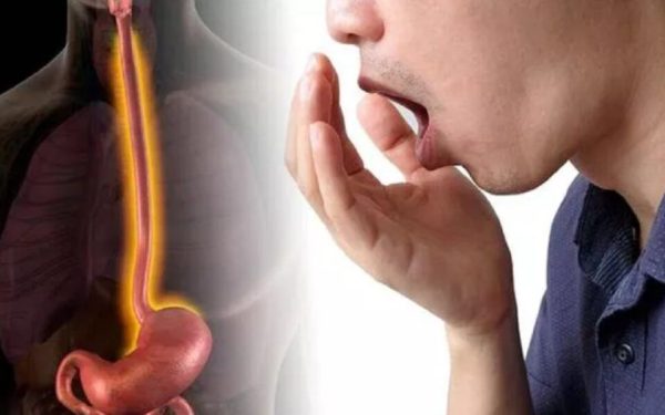 Jenantul simptom al colonului iritabil: Nu are legătură cu digestia