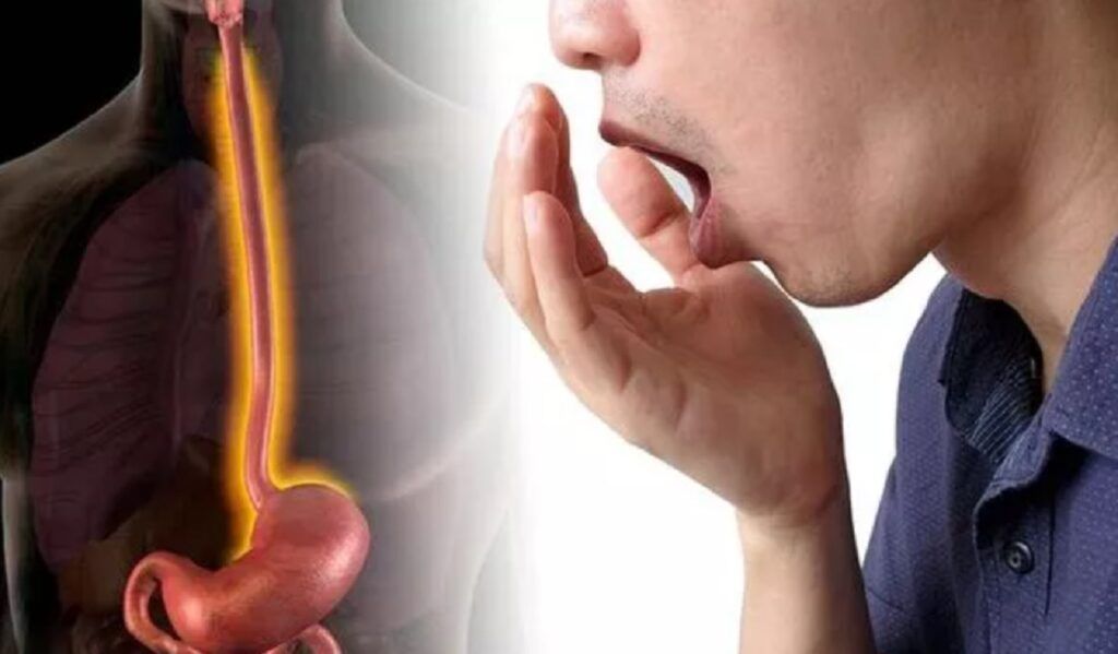 Jenantul simptom al colonului iritabil: Nu are legătură cu digestia