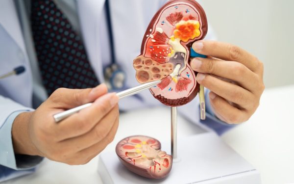 Acid uric și creatinină: Ce dezvăluie analizele despre sănătatea rinichilor?