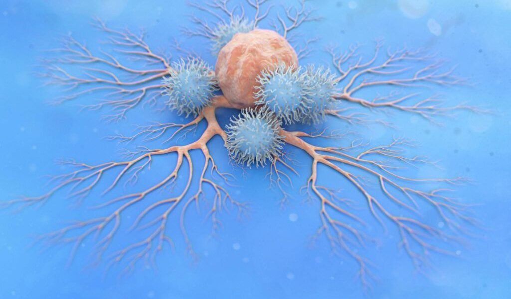 Laboratorul francez Ipsen a retras de pe piață un medicament anticanceros, inclusiv din studiile clinice aflate în desfășurare, după ce evaluările recente au arătat un raport risc-beneficiu nefavorabil