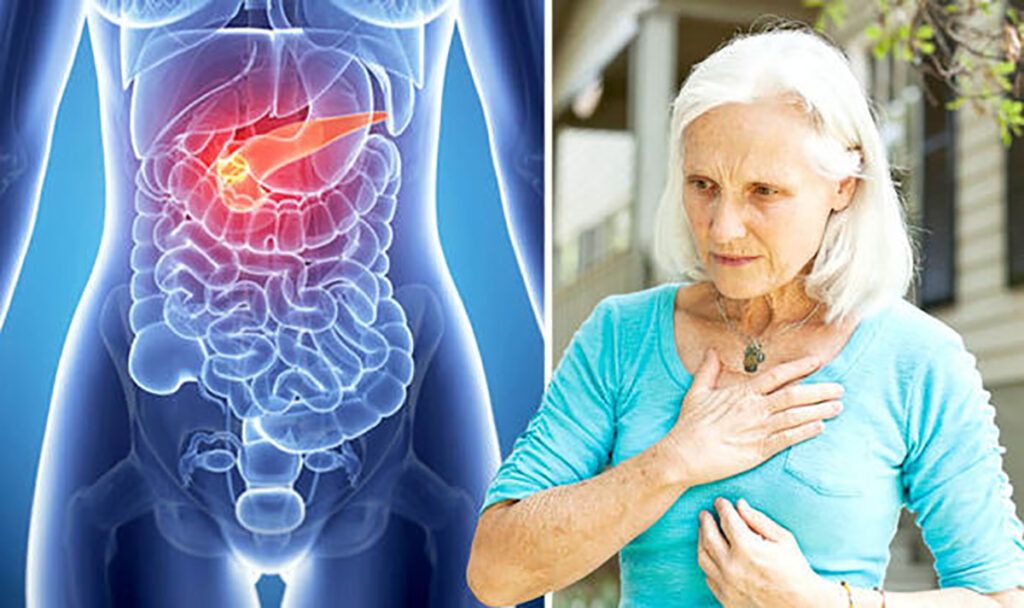 Cancerul pancreatic: Semne SUBTILE ignorate. Atenție, nu doar durerea te avertizează