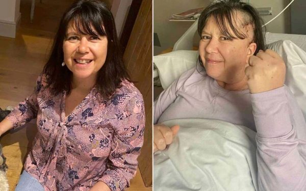 Cancer cerebral, confundat cu menopauza și anxietatea. Diagnostic fatal