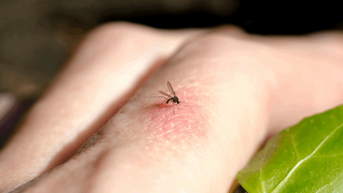 Scapă de viespi și țânțari: soluții naturale de la specialiști