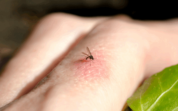 Scapă de viespi și țânțari: soluții naturale de la specialiști
